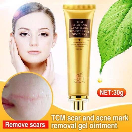 Acne scar removal cream packaging with a woman showing skin recovery effects. TCM scar and acne mark removal gel ointment.