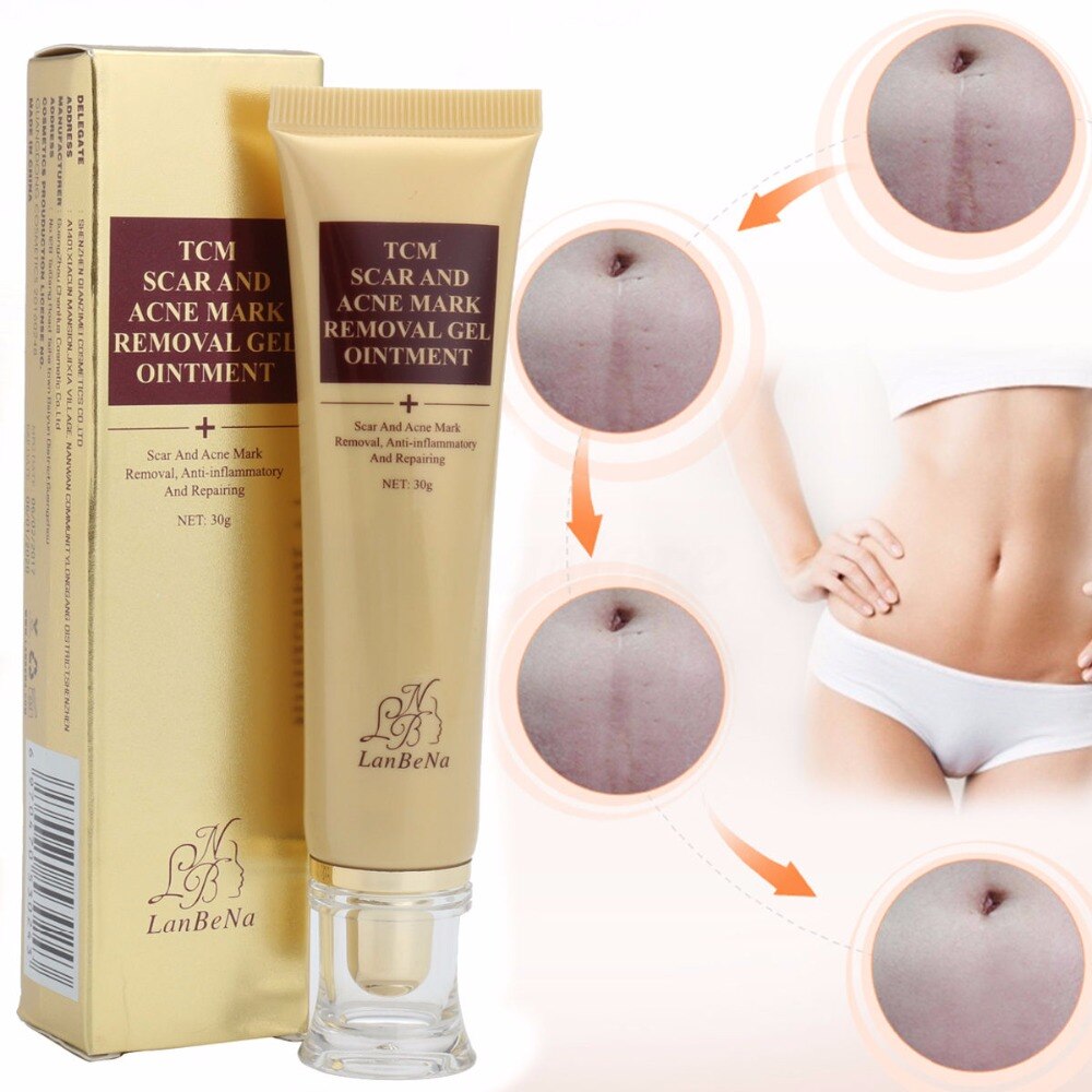 Acne scar removal cream and product packaging for effective skin repair and acne mark reduction.