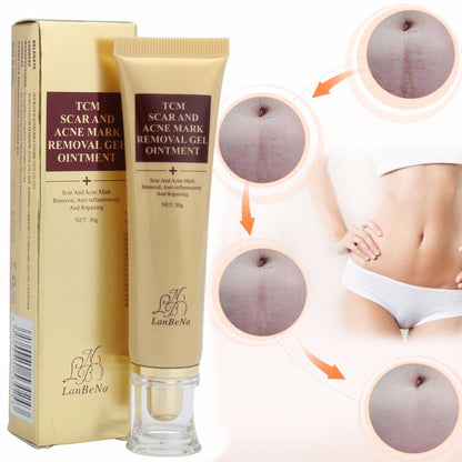 Acne scar removal cream and product packaging for effective skin repair and acne mark reduction.