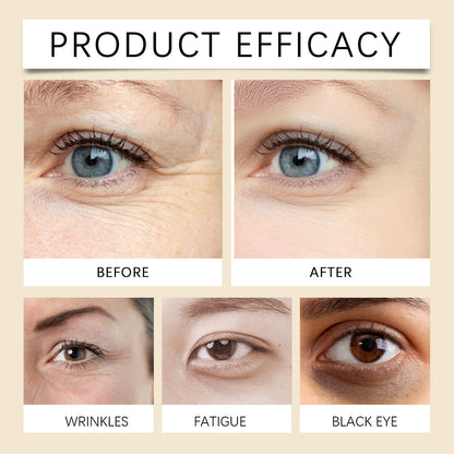 Before and after results showcasing firming eye cream for moisturizing efficacy, addressing wrinkles, fatigue, and dark circles.